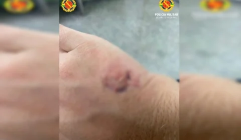 Dona de restaurante morde PM após pancadaria por causa de conta em bar