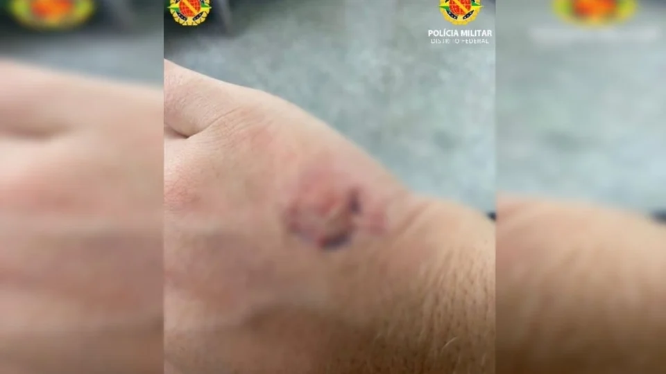 Dona de restaurante morde PM após pancadaria por causa de conta em bar