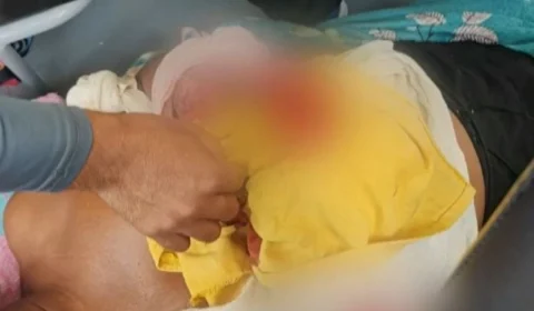 Pescador escapa de perder o braço ao ser atacado por jacaré no Amazonas