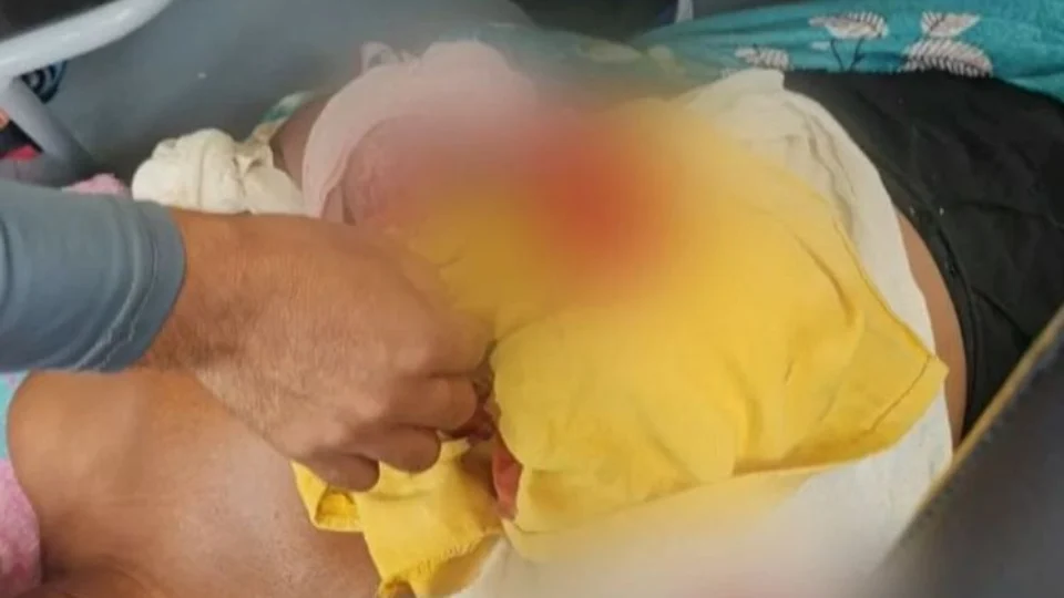 Pescador escapa de perder o braço ao ser atacado por jacaré no Amazonas