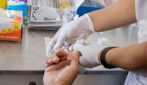 Manaus amplia oferta de Profilaxia Pré-Exposição ao HIV em unidades de saúde