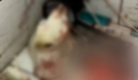 Mulher vai parar na UTI após vaso sanitário quebrar durante o uso