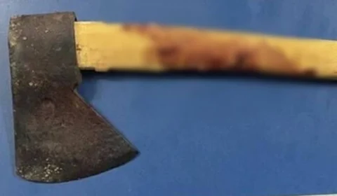 Homem tenta cortar cabeça da esposa com machado