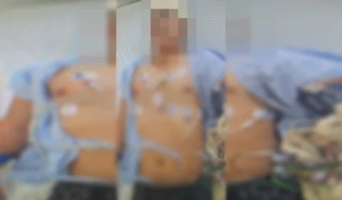 Jovem fica em estado grave na UTI após ser espancado por amigo