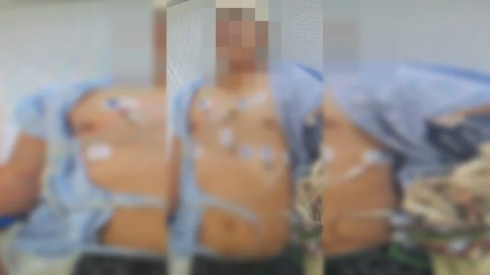 Jovem fica em estado grave na UTI após ser espancado por amigo