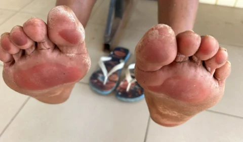 Idoso venezuelano tem celular roubado e recuperado por populares em Boa Vista