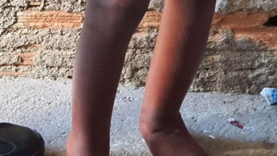 Menino encontrado acorrentado em barril em 2021 é adotado