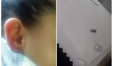 UPA manda criança com barata dentro do ouvido de volta para casa