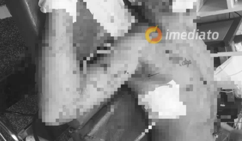 Homem é baleado no Mutirão e está em estado grave no hospital Platão Araújo