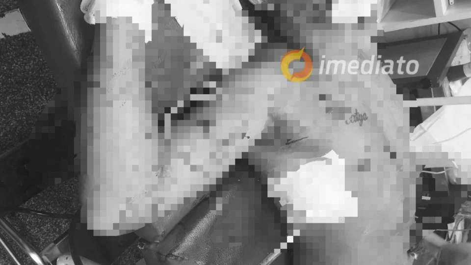 Homem é baleado no Mutirão e está em estado grave no hospital Platão Araújo