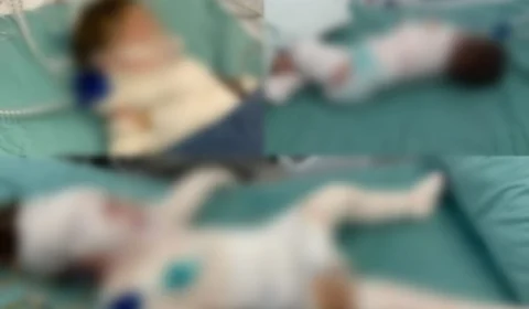 Internado há 5 dias, bebê morre após explosão de churrasqueira