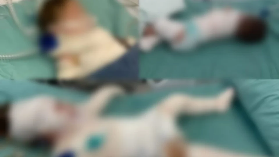 Internado há 5 dias, bebê morre após explosão de churrasqueira