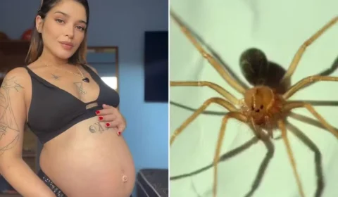Grávida tem pele da perna necrosada após ser picada por aranha venenosa