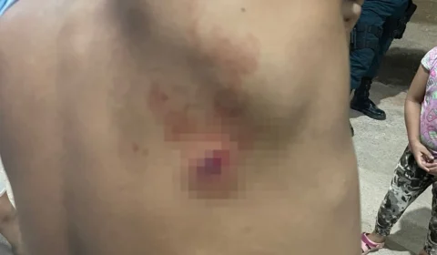 Jovem escapa de tiro por causa de mochila em Pacaraima