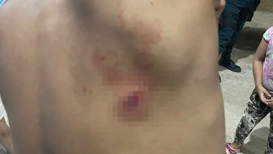 Jovem escapa de tiro por causa de mochila em Pacaraima