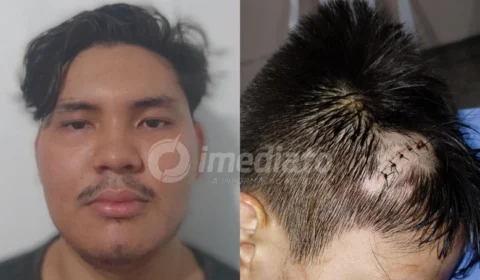 Vizinho espanca criança de 11 anos no bairro Riacho Doce em Manaus