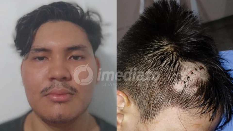 Vizinho espanca criança de 11 anos no bairro Riacho Doce em Manaus