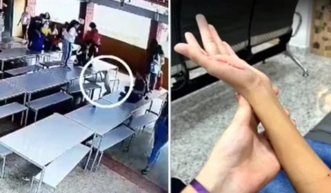 Pit bull invade escola e deixa três crianças feridas