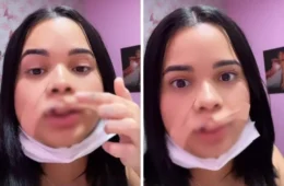 VEJA VÍDEO: influencer tem parte do lábio arrancado ao tentar beijar cachorro