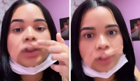 VEJA VÍDEO: influencer tem parte do lábio arrancado ao tentar beijar cachorro