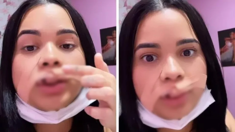 VEJA VÍDEO: influencer tem parte do lábio arrancado ao tentar beijar cachorro