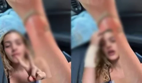 Jovem tem queimadura ao coar café direto no copo Stanley: “Explodiu”