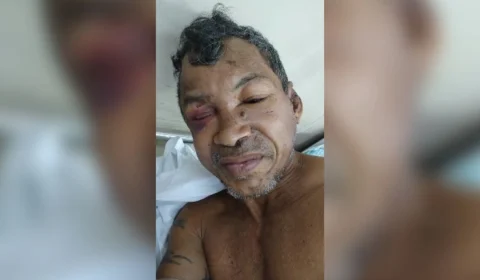 Hospital João Lúcio pede ajuda para encontrar familiares de paciente internado