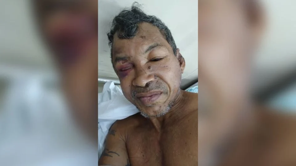 Hospital João Lúcio pede ajuda para encontrar familiares de paciente internado