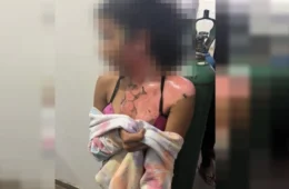 Vídeo: tia queima sobrinha de 14 anos com água fervendo