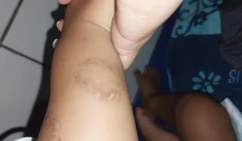 Bebê torturado continua internado em estado grave