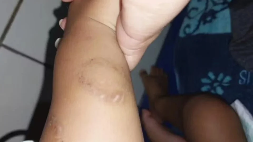 Bebê torturado continua internado em estado grave