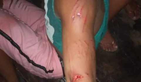 Terror no Rio Madeira: Jacaré ataca brutalmente jovem após partida de futebol