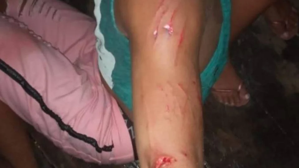 Terror no Rio Madeira: Jacaré ataca brutalmente jovem após partida de futebol