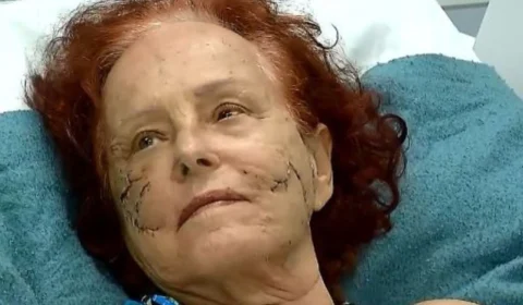 Escritora Roseana Murray recebe alta após ataque de pit bulls