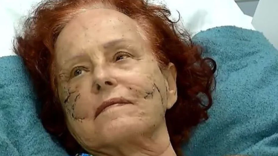 Escritora Roseana Murray recebe alta após ataque de pit bulls