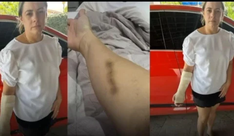 Deputado Estadual Renato Silva é acusado de agressão em Bar de Boa Vista