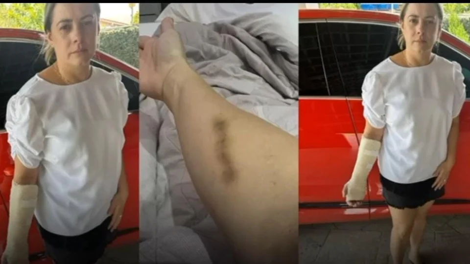 Deputado Estadual Renato Silva é acusado de agressão em Bar de Boa Vista