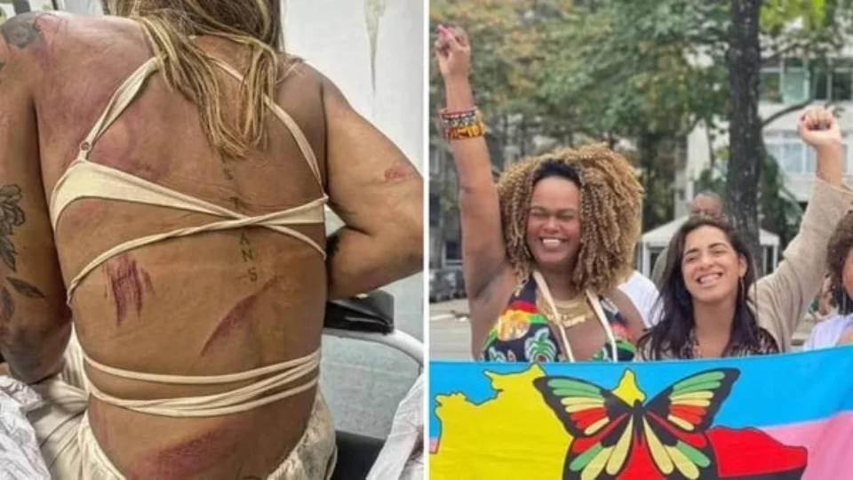 Trans, assessora de vereadora de Niterói é agredida em bar no RJ