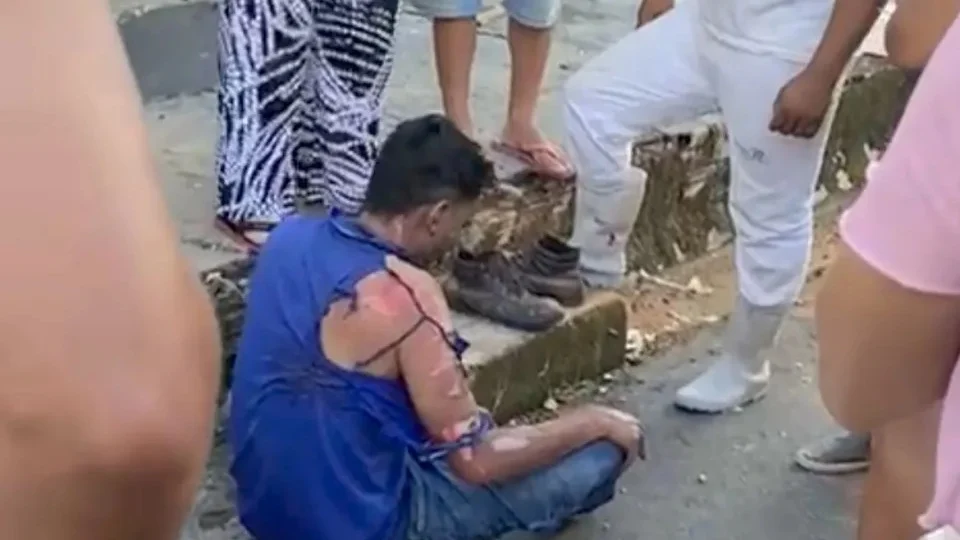 VÍDEO: pintor cai em cima de fio e recebe descarga elétrica em Manaus