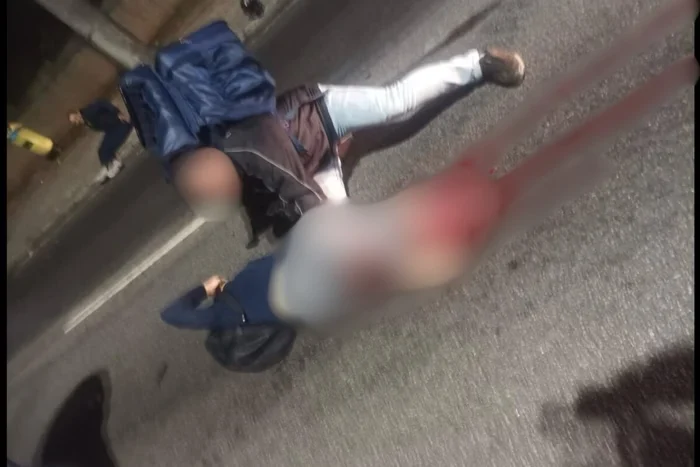 Mulher tem perna arrancada por carro de luxo que fazia racha ilegal em São Paulo