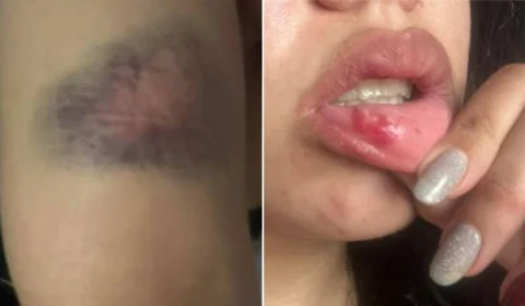 Cantora Jhenifer Gisele é agredida pelo namorado em Manaus