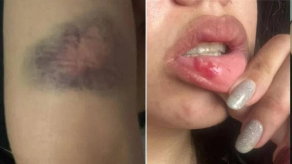 Cantora Jhenifer Gisele é agredida pelo namorado em Manaus