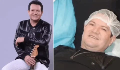 Guitarrista Ximbinha faz cirurgias no rosto e nariz: “Vou ficar gatinho”