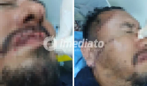 Assaltantes invadem ônibus e esfaqueiam motorista na cabeça em Manaus