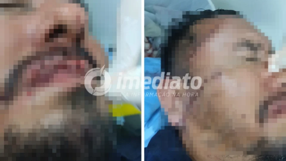 Assaltantes invadem ônibus e esfaqueiam motorista na cabeça em Manaus