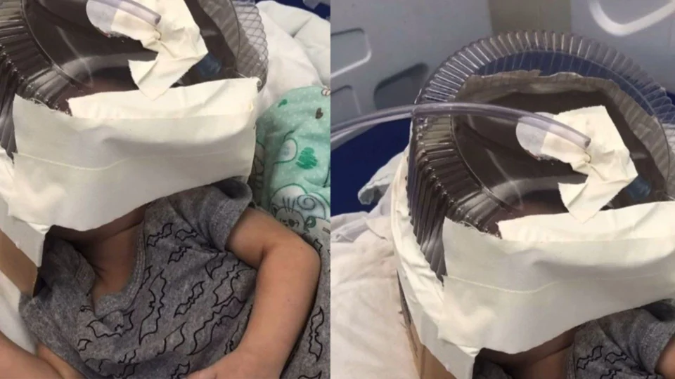 Bebê de 3 meses usa máscara de oxigênio improvisada com embalagem de bolo enquanto espera por vaga em UTI