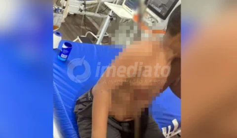 VEJA VÍDEO: menino fica com vergalhão atravessado no peito após brincar em obra
