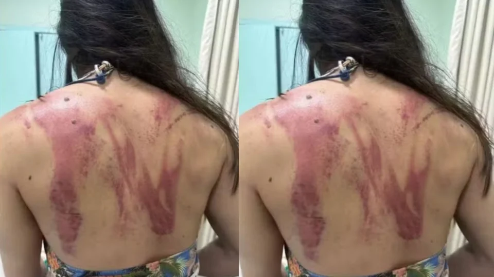 ‘Seria meu último dia’, diz mulher que quase foi morta pelo próprio pai, no interior do Pará