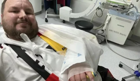 Atacante da Alemanha quebra a mão de torcedor com ‘bolada’