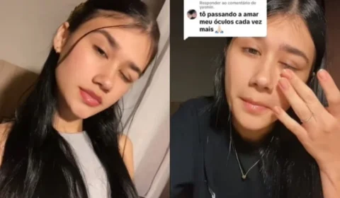 Jovem fica cega e entra na fila do transplante por mau uso de lente